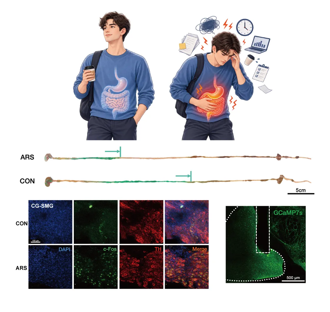 Research overview with an illustration of stress and the gut, gastrointestinal transit comparisons, CG-SMG fluorescence images and a neural labeling image.